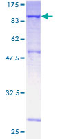 DMPK / DM Protein - 12.5% SDS-PAGE of human DMPK stained with Coomassie Blue