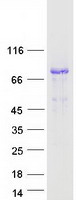 DMPK / DM Protein - Purified recombinant protein DMPK was analyzed by SDS-PAGE gel and Coomassie Blue Staining