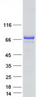 DMPK / DM Protein - Purified recombinant protein DMPK was analyzed by SDS-PAGE gel and Coomassie Blue Staining