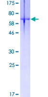 DMRT1 Protein - 12.5% SDS-PAGE of human DMRT1 stained with Coomassie Blue