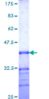 DMRTA1 Protein - 12.5% SDS-PAGE Stained with Coomassie Blue.