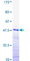 DMTF1 Protein - 12.5% SDS-PAGE Stained with Coomassie Blue.
