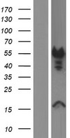 DMTN / Dematin Protein - Western validation with an anti-DDK antibody * L: Control HEK293 lysate R: Over-expression lysate