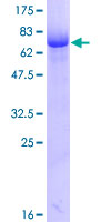 DMTN / Dematin Protein - 12.5% SDS-PAGE of human EPB49 stained with Coomassie Blue