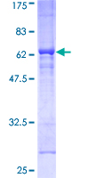 DMWD Protein - 12.5% SDS-PAGE of human DMWD stained with Coomassie Blue