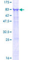 DNAH6 Protein - 12.5% SDS-PAGE of human LOC200383 stained with Coomassie Blue