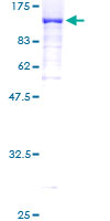 DNAI1 Protein - 12.5% SDS-PAGE of human DNAI1 stained with Coomassie Blue