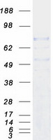 DNAI1 Protein - Purified recombinant protein DNAI1 was analyzed by SDS-PAGE gel and Coomassie Blue Staining