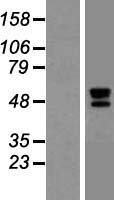 DNAJA3 / TID1 Protein - Western validation with an anti-DDK antibody * L: Control HEK293 lysate R: Over-expression lysate