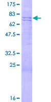 DNAJA3 / TID1 Protein - 12.5% SDS-PAGE of human DNAJA3 stained with Coomassie Blue