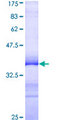 DNAJA3 / TID1 Protein - 12.5% SDS-PAGE Stained with Coomassie Blue.