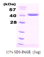 DNAJB1 / Hsp40 Protein