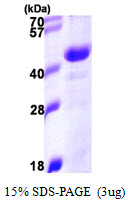 DNAJB11 Protein