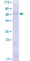 DNAJB14 Protein - 12.5% SDS-PAGE of human DNAJB14 stained with Coomassie Blue
