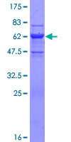 DNAJB2 Protein - 12.5% SDS-PAGE of human DNAJB2 stained with Coomassie Blue