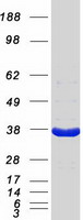 DNAJB2 Protein - Purified recombinant protein DNAJB2 was analyzed by SDS-PAGE gel and Coomassie Blue Staining