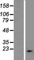 DNAJB3 Protein - Western validation with an anti-DDK antibody * L: Control HEK293 lysate R: Over-expression lysate