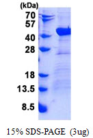 DNAJB4 Protein