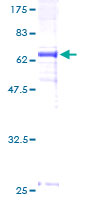 DNAJB5 Protein - 12.5% SDS-PAGE of human DNAJB5 stained with Coomassie Blue
