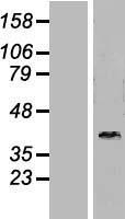 DNAJB6 Protein - Western validation with an anti-DDK antibody * L: Control HEK293 lysate R: Over-expression lysate