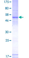 DNAJB6 Protein - 12.5% SDS-PAGE of human DNAJB6 stained with Coomassie Blue