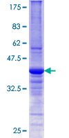 DNAJB6 Protein - 12.5% SDS-PAGE Stained with Coomassie Blue.