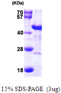 DNAJB6 Protein