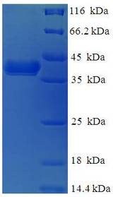 DNAJB8 Protein