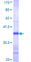 DNAJC10 Protein - 12.5% SDS-PAGE Stained with Coomassie Blue.