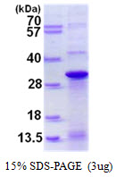 DNAJC12 Protein