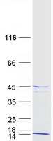 DNAJC15 Protein - Purified recombinant protein DNAJC15 was analyzed by SDS-PAGE gel and Coomassie Blue Staining