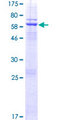 DNAJC18 Protein - 12.5% SDS-PAGE of human DNAJC18 stained with Coomassie Blue