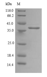 DNAJC19 Protein - (Tris-Glycine gel) Discontinuous SDS-PAGE (reduced) with 5% enrichment gel and 15% separation gel.