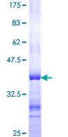 DNAJC19 Protein - 12.5% SDS-PAGE Stained with Coomassie Blue.