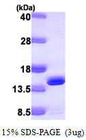 DNAJC19 Protein