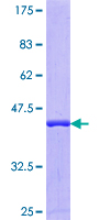 DNAJC2 / ZRF1 Protein - 12.5% SDS-PAGE Stained with Coomassie Blue.