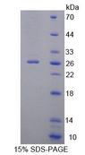 DNAJC2 / ZRF1 Protein - Recombinant Zuotin Related Factor 1 By SDS-PAGE