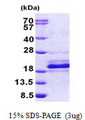 DNAJC24 Protein
