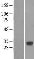 DNAJC27 Protein - Western validation with an anti-DDK antibody * L: Control HEK293 lysate R: Over-expression lysate