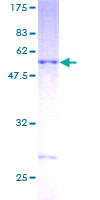 DNAJC27 Protein - 12.5% SDS-PAGE of human DNAJC27 stained with Coomassie Blue
