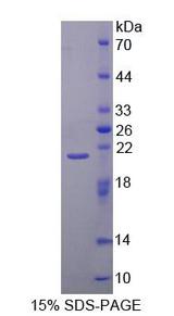 DNAJC4 Protein - Recombinant Heat Shock 40kDa Protein 2 By SDS-PAGE