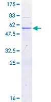 DNAJC5 / CSP Protein - 12.5% SDS-PAGE of human DNAJC5 stained with Coomassie Blue