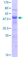 DNAJC5B Protein - 12.5% SDS-PAGE of human DNAJC5B stained with Coomassie Blue