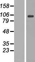 DNAJC6 Protein - Western validation with an anti-DDK antibody * L: Control HEK293 lysate R: Over-expression lysate