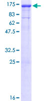 DNAJC6 Protein - 12.5% SDS-PAGE of human DNAJC6 stained with Coomassie Blue