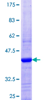 DNAJC6 Protein - 12.5% SDS-PAGE Stained with Coomassie Blue.