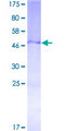DNAJC7 Protein - 12.5% SDS-PAGE of human DNAJC7 stained with Coomassie Blue