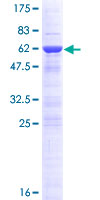 DNAJC8 Protein - 12.5% SDS-PAGE of human DNAJC8 stained with Coomassie Blue