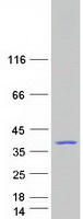 DNAJC8 Protein - Purified recombinant protein DNAJC8 was analyzed by SDS-PAGE gel and Coomassie Blue Staining