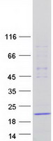 DNAL1 Protein - Purified recombinant protein DNAL1 was analyzed by SDS-PAGE gel and Coomassie Blue Staining